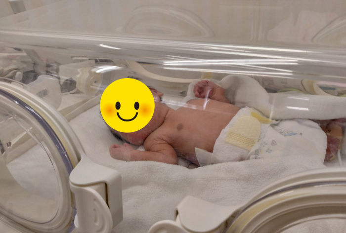 生後すぐにNICUに入院されたお子様